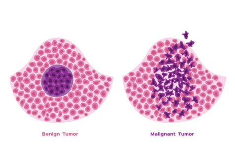 Tumor markers blood tests