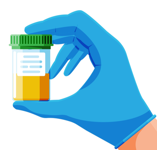 urinalysis a routine urine analysis test
